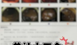 肠镜怎么做的过程视频,直观视频带你了解每一步