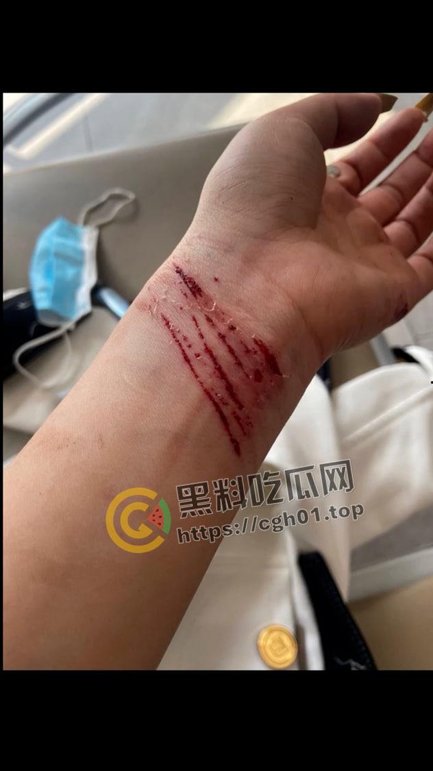 抖音三千万粉丝网红【董先生】被实名举报强奸 警察局不予受理 是手大遮天还是臭网红炒作-11